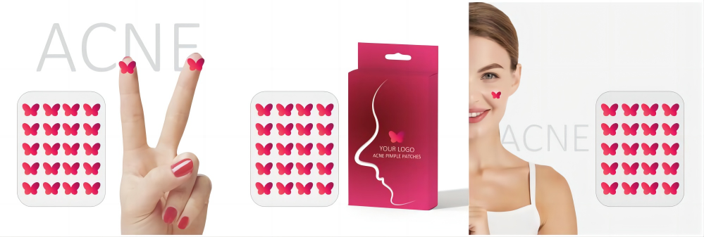 butterfly shape acne butterfly shape acne